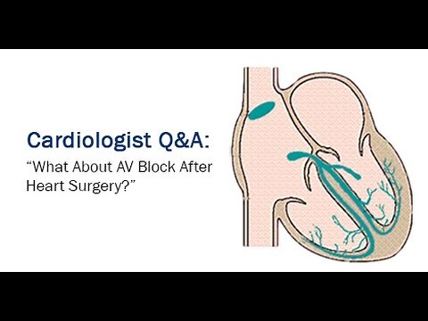 Atrioventricular Block (AV Block) After Heart Valve Surgery