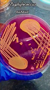 staphylococcus aureus #microbiology #science #experiment #explore #shortvideo #infection