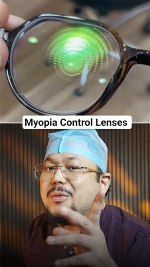 These lenses can slow down the increase of your prescription #lens #eyecare