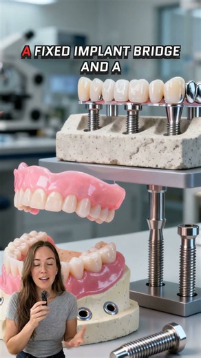 How much does a full set of implants usually cost in Ventura, CA?
