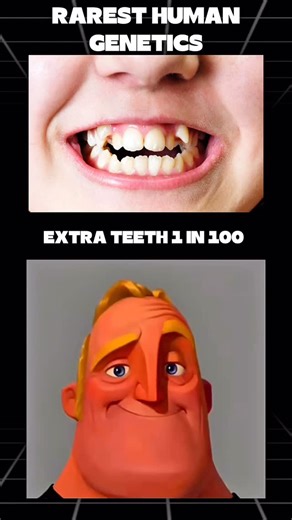 Mr Incredible Files on Instagram: "Rarest Human Genetics 😱"