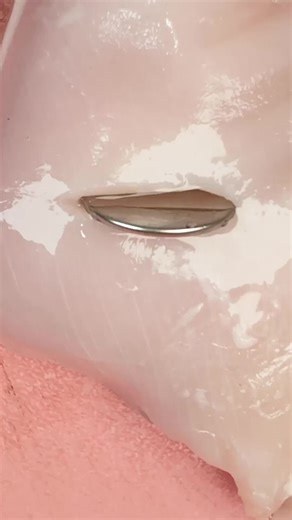 A raw chicken test dramatizes button battery dangers: hidden current, caustic burns, and rapid tissue damage. Learn how to prevent accidents and why you must act immediately. #BatteryDanger #ChickenTest #HiddenCircuit #MedicalEmergency #HomeSafety