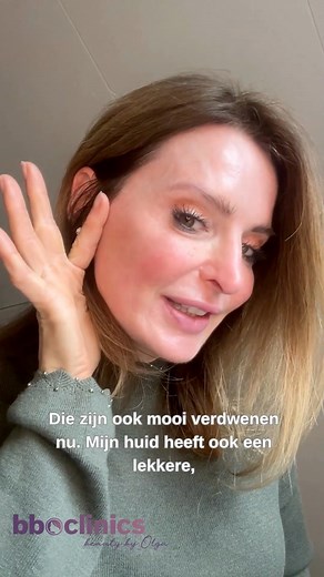 7.5K views · 58 reactions | TCA vs. PRX – wat is nou het verschil? +...