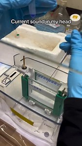 3.6K views · 5.2K reactions |  #microbiology #microbiologist #lab #laboratory #mikrobiyoloji #microbiologia #electrophoresis #fyp #viral #explore #kesfet #bacteria #virus #fungi #parasite #bakteri #virüs #mantar #parazit #life #knowledge #know #fact #reel #microbe #science #molecular #bacteriology #virology #phd | Medical Microbiologist | Facebook