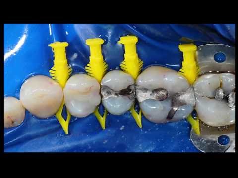 Biofit, Chapter 2: The Five Steps to Success with the Biofit Matrix System