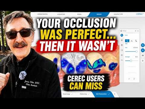 Why CEREC Restorations Suddenly Start Milling High (And How to Fix It)