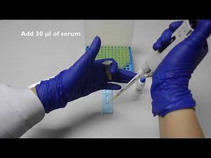 TYPHIDOT RAPID IgM TEST Instruction Video