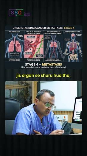 Why Is Stage 4 Cancer Hard to Cure? | Cancer Stages Explained Clearly! | Dr Praveen Kammar, Mumbai