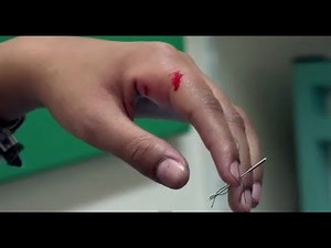 Sewing Accident - Bizarre ER