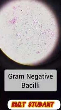 Gram Staining Procedure Step by Step|Microbiology Practical in Hindi| Complete Procedure & Result