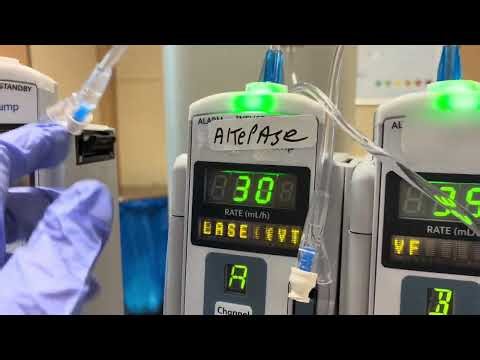 EKOS ( Catheter Directed Thrombolysis )