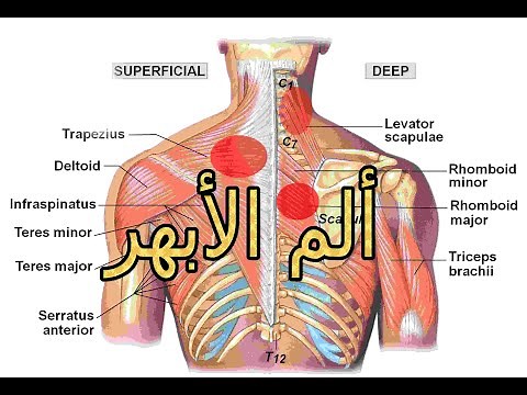 ماهو ألم الأبهر ( الألم بين الأكتاف)) وما علاجه والوقاية منه؟؟؟؟