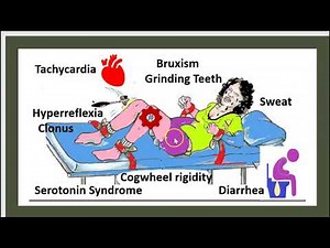 Médecine en 2 minutes : Syndrome sérotoninergique / Syndrome malin des neuroleptiques /