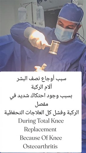 Wasim Zeyad Saleh on Instagram‎: "#مفصل_الحوض #مفصل_الورك #مفصل_الورك_الصناعي #مفصل_الورك_والركبة #زراعة_مفاصل"‎