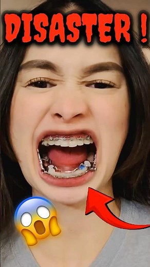 This Jaw Fixing Device Actually Moves Your Bone 👀🦷