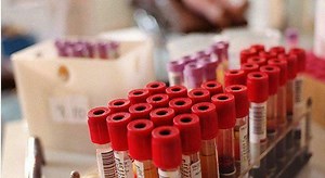 Asl, esauriti i budget analisi e tac si pagano