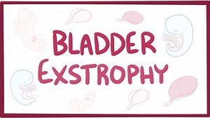 Bladder exstrophy: Video, Causes, & Meaning | Osmosis