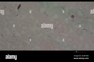 Trypanosoma pathogen