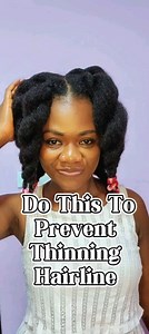 Have you heard of traction alopecia? Did you know that some of your everyday hairstyles could land you with traction alopecia over a period of time? Some of us hold our hair back 11 out of 12 months in a year. Watch this video and specie things up a bit with your styling. #yanumenherhair #yanume #naturalhair #healthyhair #healthynaturalhair #healthyafrohair #afrohair #afrohairstyle #afro #blackhair #naturalhaircare #afrohaircare #hairgoals #haircaretips #kinkycoilyhair #hairvideos #hairline #how