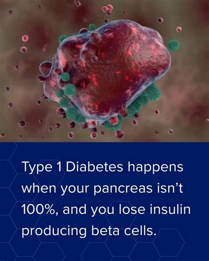 End your diabetes with the nation’s best pancreas transplant program. https://uw.health/4brih2L | UW Health