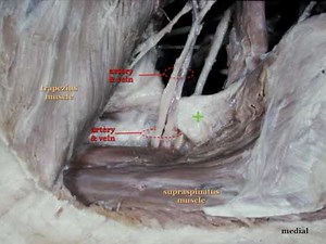 Suprascapular Nerve Block