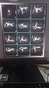 10K views · 85 reactions | MRCP Post processing | CT Scan and MRI study | Facebook