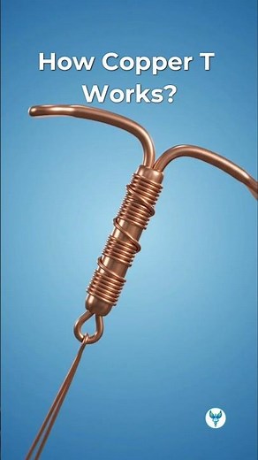 How The Copper IUD Works: Hormone-Free Birth Control #baby #birthcontrol