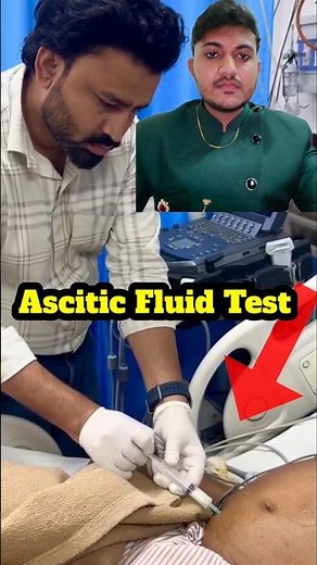 ascitic fluid test #ascites #paracentesis #stomachproblem #abdomenpain