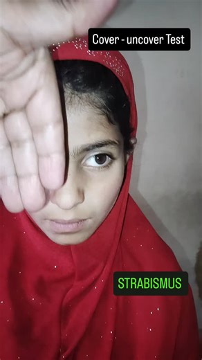 Refractionist _YasirButt on Instagram: "Cover - uncover Test Cover–Uncover Test (Ophthalmology) Definition The Cover–Uncover Test is a simple clinical test used to detect ocular misalignment (squint/strabismus) and to differentiate tropia (manifest deviation) from phoria (latent deviation). --- Purpose Detect manifest squint (tropia) Identify the fixating eye Differentiate tropia vs phoria --- Procedure 1. Ask the patient to fixate on a distant or near target. 2. Cover one eye for 2–3 seconds. 3