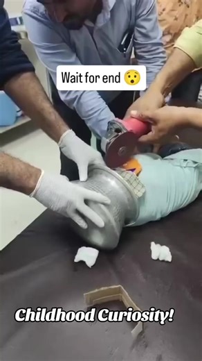 Don't get furious, they are only curious! | Childhood