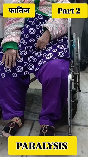 लक़वा #paralysis #sciatica #youtubeshorts #shortsfeed #shortvideo #shortsviral #shorts #slipdisc