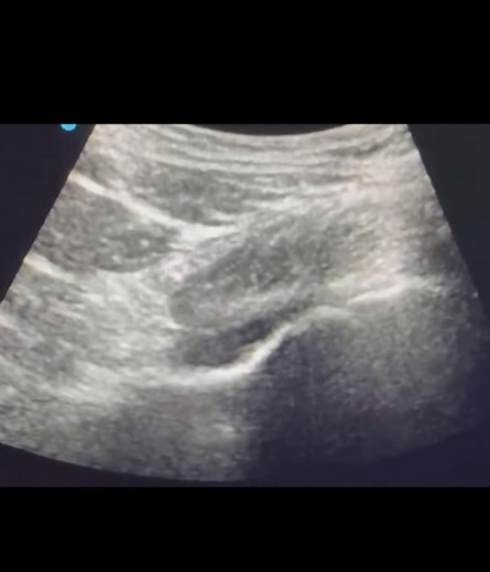 PENG block | Wiquar Ahmed