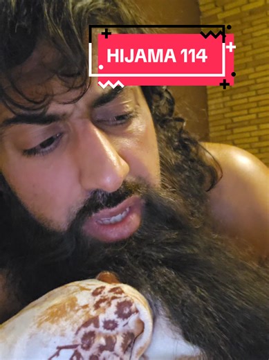 Hijama: Sunnah Therapy & Natural Healing