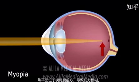 医学普及演示：眼球结构、成像原理以及近视远视成因