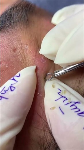 For skin consultation or product purchase, please contact us via the LQSPA Beauty Institute Fanpa...