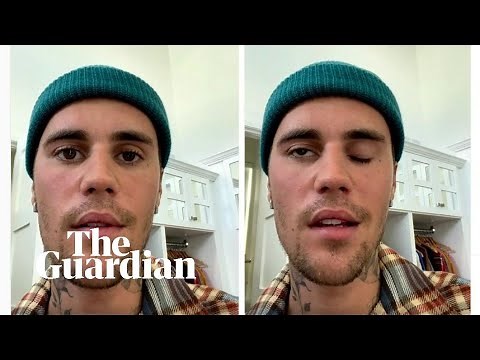 Justin Bieber cancels shows after half of face left paralysed by virus