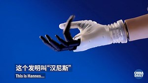 43K views · 157 shares | Italian Institute of Technology has developed a bionic hand that performs more than 90 percent of the functions of a human hand. | China Daily | Facebook