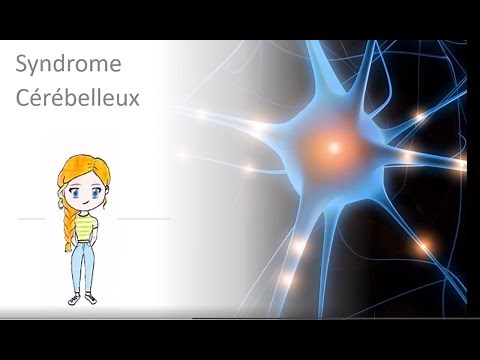 Syndrome cérébelleux