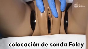 Colocación de Sonda Foley: Guía Completa La colocación de una sonda Foley es un procedimiento que consiste en insertar un tubo flexible (la sonda Foley) a través de la uretra hasta la vejiga urinaria. La sonda Foley permite el drenaje continuo de la orina hacia una bolsa colectora. Indicaciones: La colocación de una sonda Foley puede estar indicada en diversas situaciones, incluyendo: - Retención Urinaria: Incapacidad para vaciar la vejiga, ya sea por obstrucción (por ejemplo, hiperplasia prostá