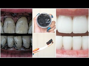 DIY CHARCOAL Teeth Whitening│How To Make Charcoal Toothpaste at Home For White Teeth in MINUTES!
