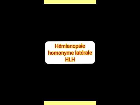 Hémianopsie latéral homonyme