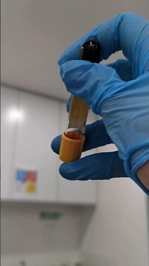 Serum Separator Tube #phlebotomy #medicaltechnologist #bloodcoll5