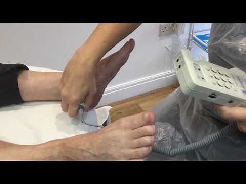 Doppler sounds in the feet