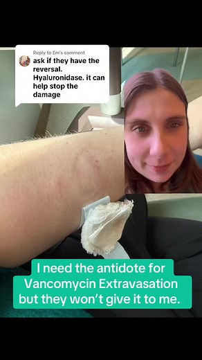 Understanding Vancomycin Extravasation and Treatment Options