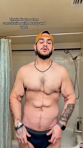 Thank you @beautyandlightsolutions and @sandrabillick for giving me this opportunity and for setting me free from this body prison. #weightloss #bodytransformation #selfcare | Garrettolsonweightloss