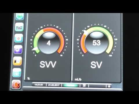 Optimise II EV1000 set up demonstration