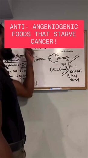 3.9K views · 2.8K reactions | HOW TO STARVE CANCER! #createdtoheal #naturalremedies #nature #greens #juice #juicing #herbals #angiogenesis #terrain #cancer #humanity #detox #food #diet | Jasiel Created To Heal | Facebook