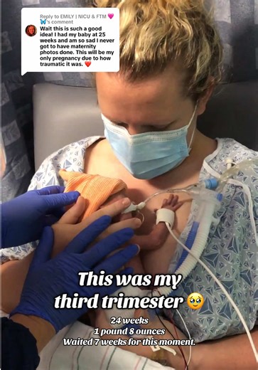 Supporting Families with NICU Micro Preemies