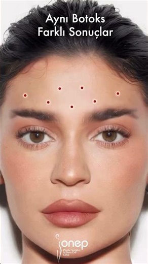 how to inject botox .... botox injection guide