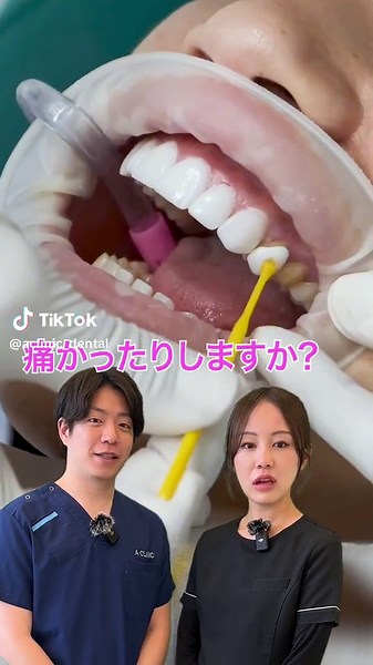 歯が綺麗になる魔法の施術✨ #dental #歯医者 #Aクリニック #ラミネートベニア